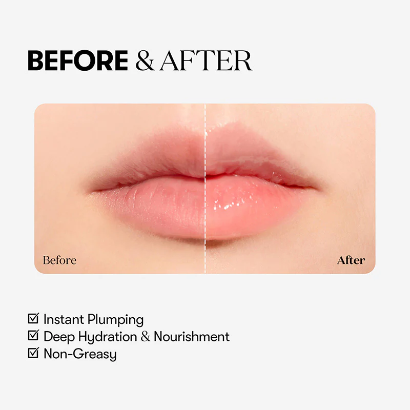 Reedle Shot Lip Plumper Beginner - Image 6
